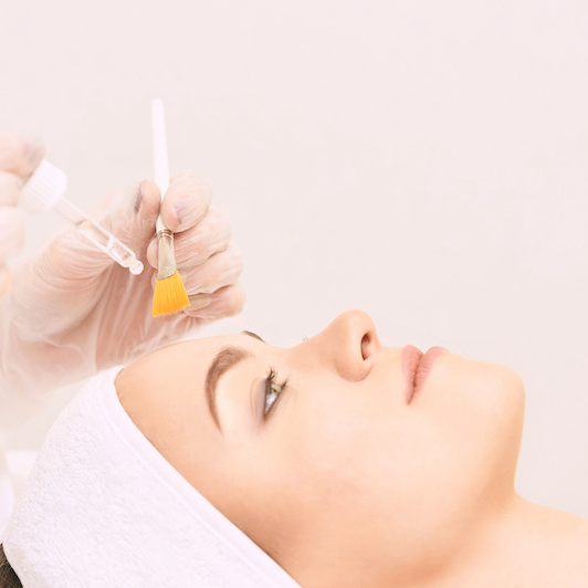 Fruchtsäure-Peeling vor einer Microneedling Behandlung