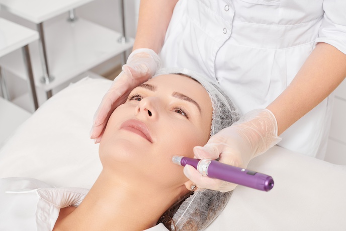 Medizinisches oder kosmetisches Microneedling bei einer Frau