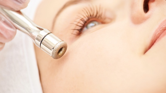 Microdermabrasion: Frauengesicht mit Microdermabrasions-Gerät