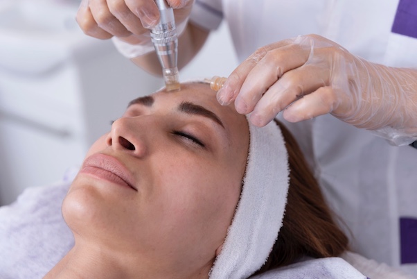 Frau bei einer Microneedling-Behandlung mit einem Dermapen