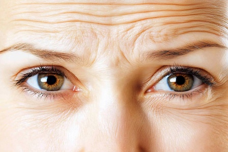 Mimikfalten mit Microneedling-Serum behandeln