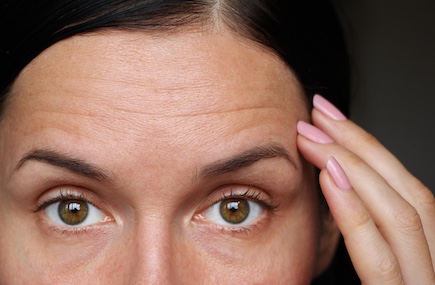 Microneedling Stirnfalten: Mit Dermapen & Dermaroller Falten behandeln