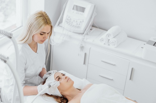 Microneedling-Behandlung bei einer Frau