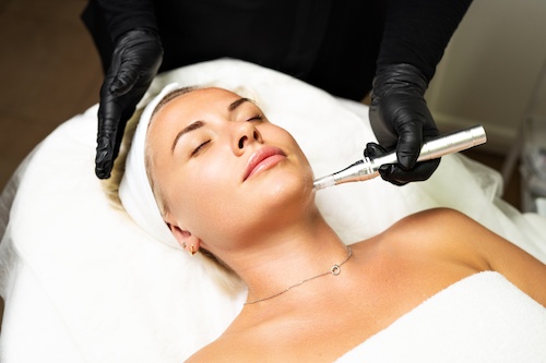 Frau bei einer Microneedling-Behandlung mit einem Dermapen